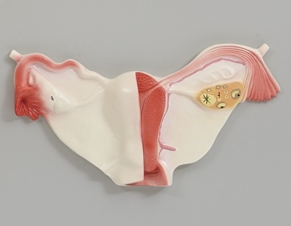 <p>Ovary</p>