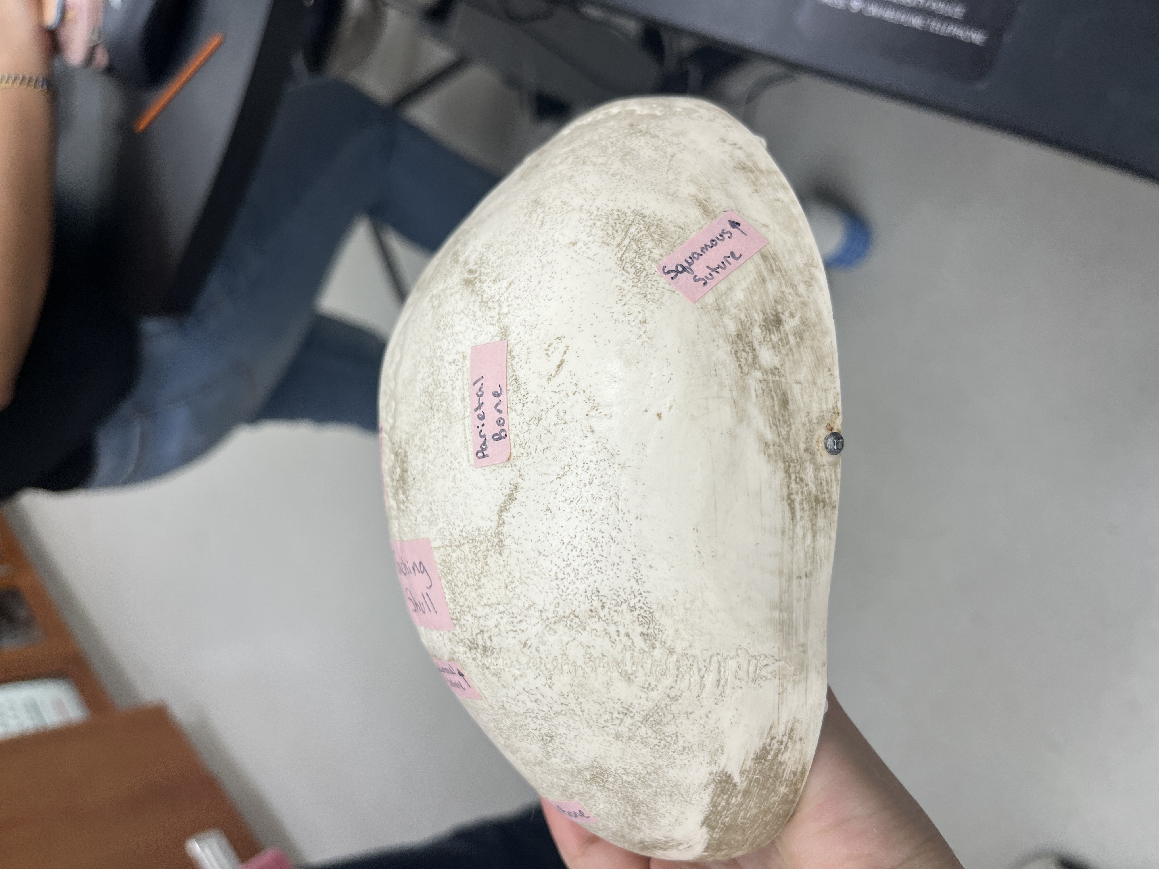 <p>joins frontal and occipital lobes, divided by saggital suture</p>