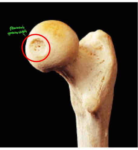 <p>Identify this </p>