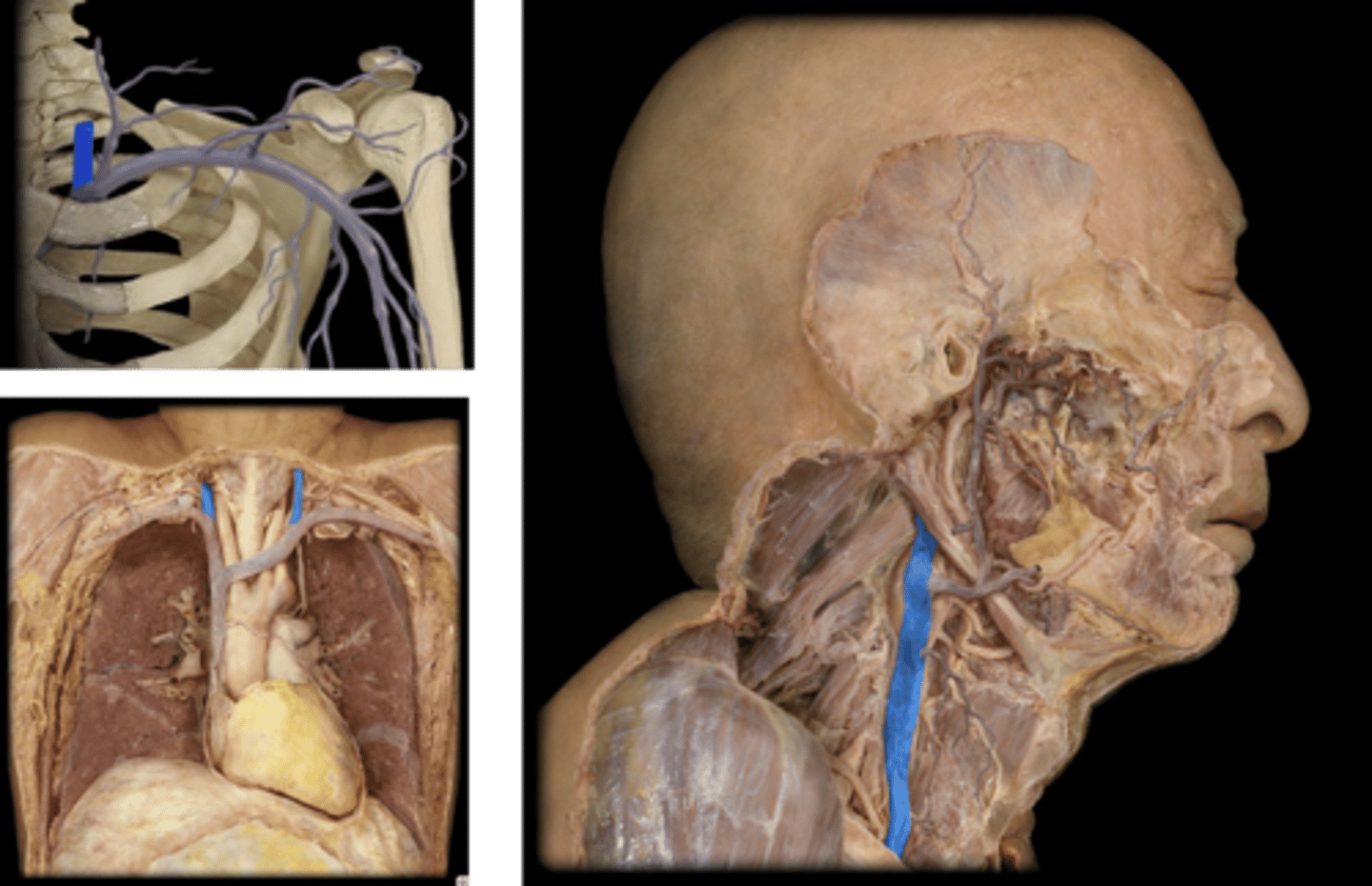 <p>Name these vessels.</p>