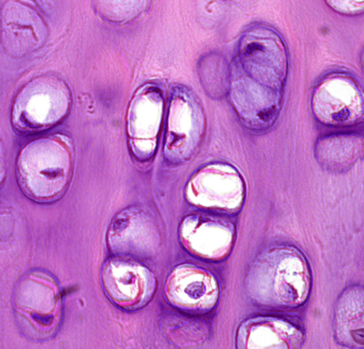 <p>most common</p><p>wear-resistant</p>