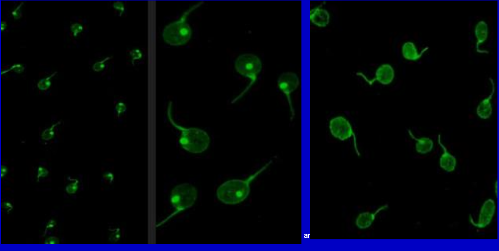 <p>One type of assay for anti ds-DNA is an immunofluorescent test using <strong><em>Crithidia luciliae</em></strong>, a hemoflagellate, as the substrate. This organism has ds-DNA in the kinetoplast. This test has a high degree of specificity, because high titers help confirm the diagnosis of SLE, but about one-fourth of patients with SLE do not have this antibody.</p>