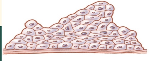 <p>What cellular adaptation is this?</p>