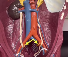 <p>Identify the blood vessel.</p>