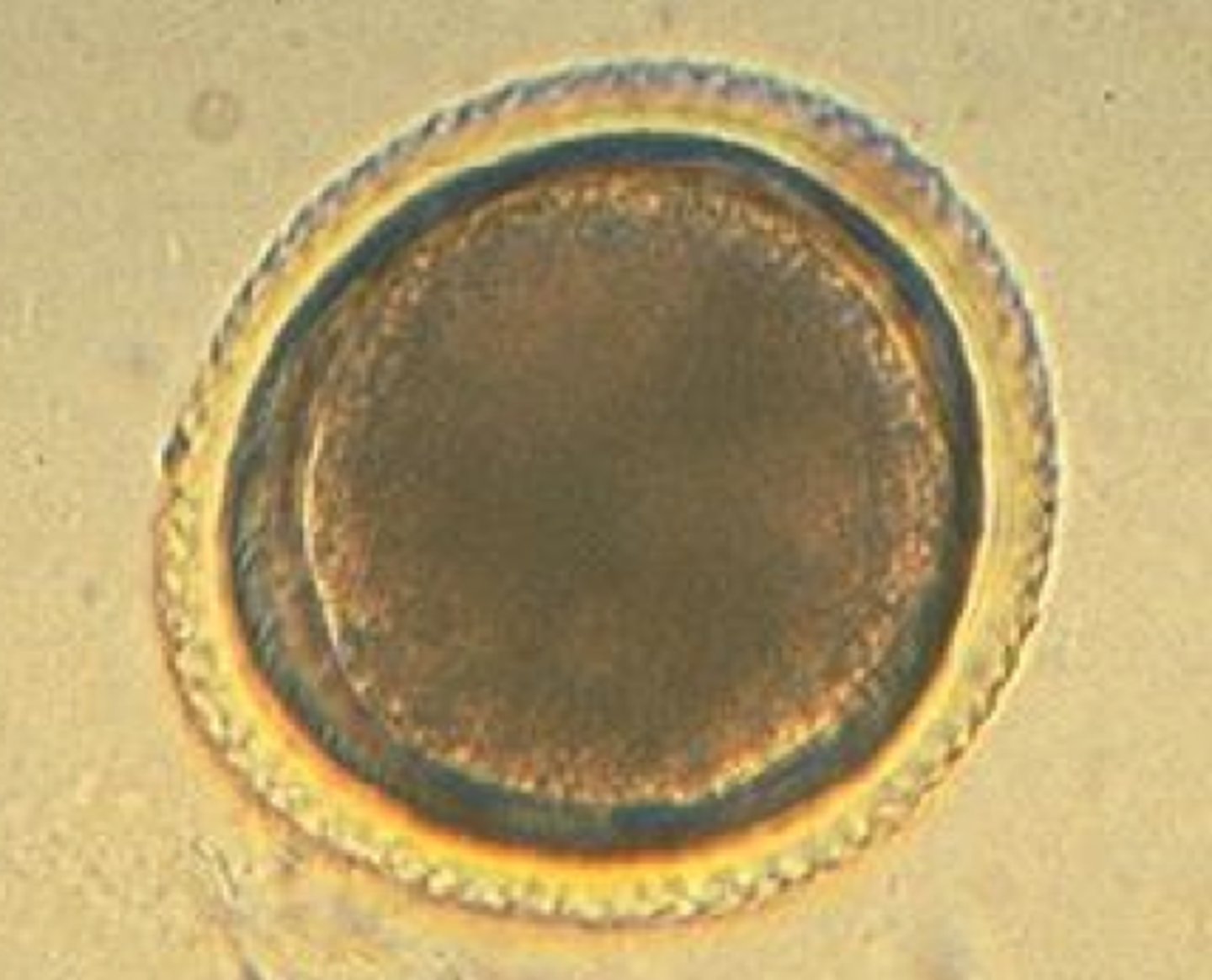 <p>PHASMID nematode; LARVA in TISSUE causing VISCERAL and OCULAR LARVA MIGRANS diagnosed by serology</p><p>MOT: ingestion of MEBRYONATED egg</p>