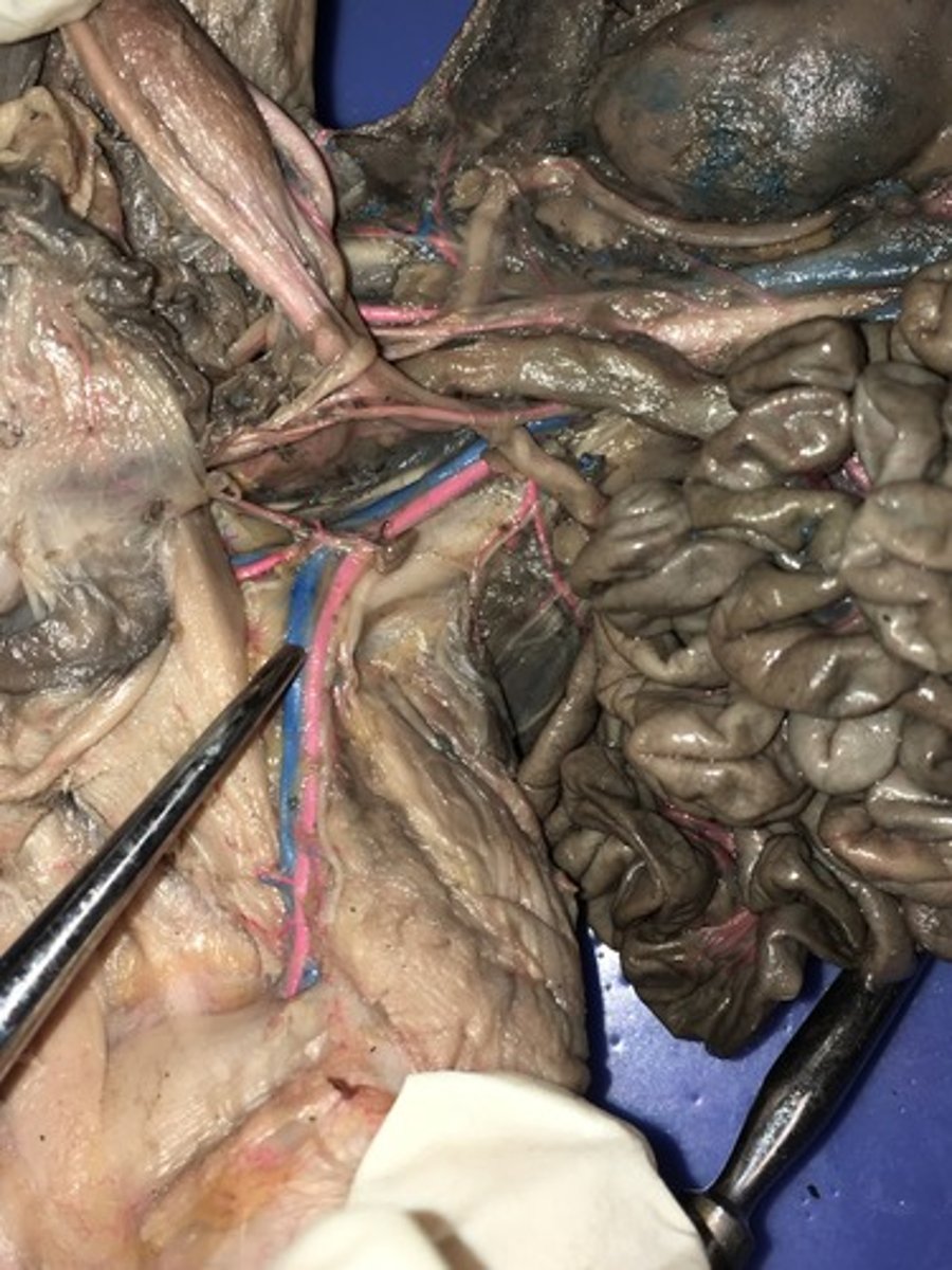 <p>External iliac veins</p>