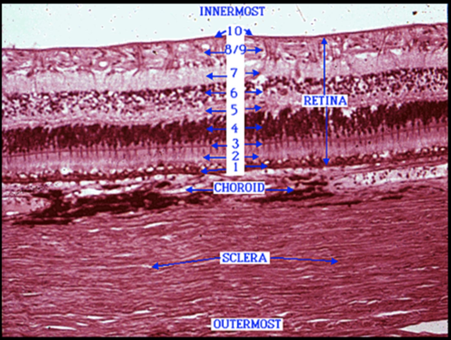 <p>Identify the layer of the retina (10)</p>