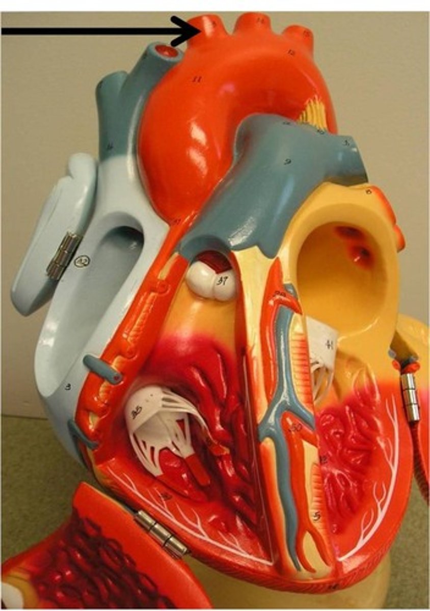 <p>Area supplied: Right side of the head, neck, and upper arm</p><p>Terminal branch: Right common carotid and right subclavian arteries</p><p>Relationship: First branch of the aortic arch</p>