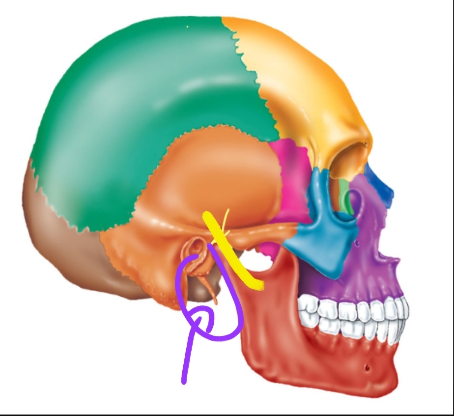 term image