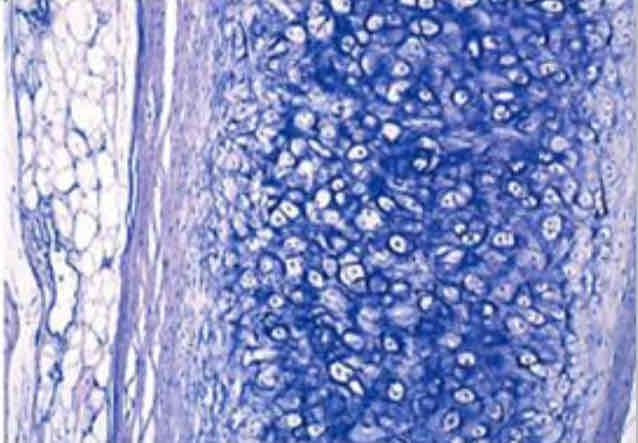 <p>All cartilage has chondrocytes (“cells within cells”), almost looks like many miniature eyes</p>