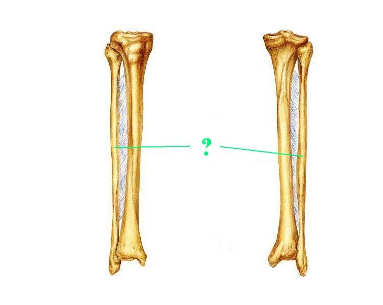 <p>Is the indicated bone from the right or left side of the body?</p>