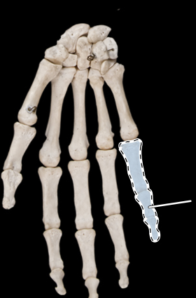 <p>Bones of the hand, anterior view, right side</p>