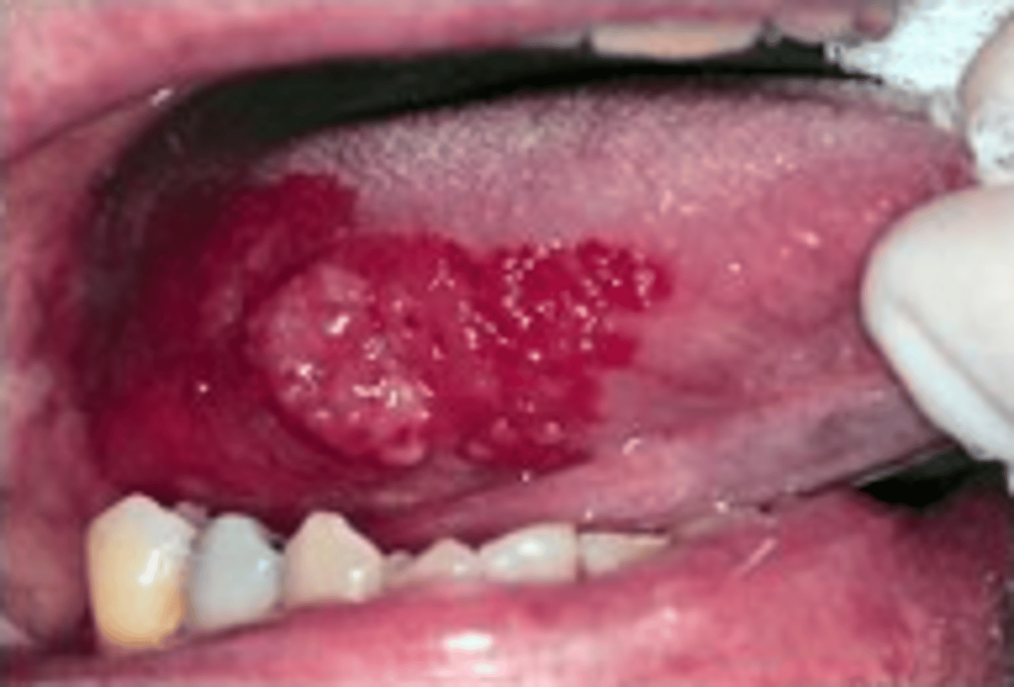 <p>Describe the appearance of the lesions:</p>