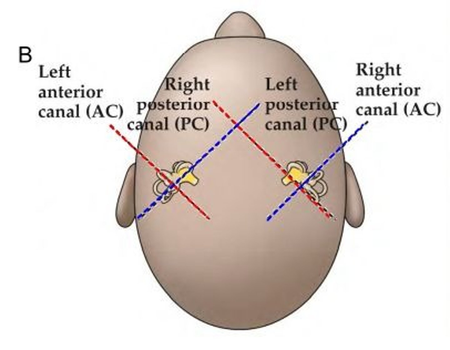 <p>a specific movement will excite one canal while resulting in the inhibition of another canal. this is due to the way they are aligned in the head and to each other. the pairs lie in parallel with each other, so drawing it out might help.</p><p>Left Anterior plane <--> Right Posterior plane</p><p>Right Anterior plane <--> Left Posterior plane</p><p>Right Horizontal plane <--> Left Horizontal plane</p>