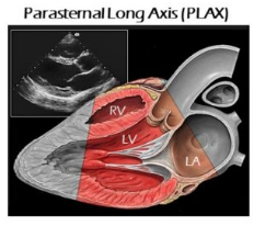 <p>How is a patient prepared for an echocardiography exam regarding monitoring?</p>
