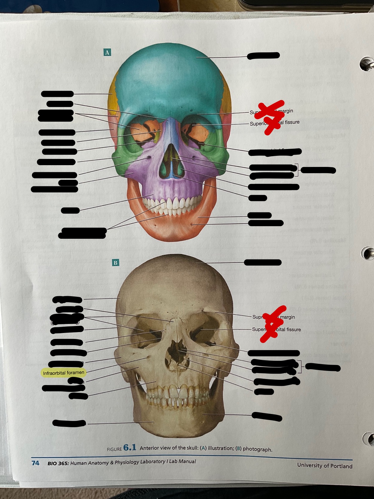 Infraorbital foramen