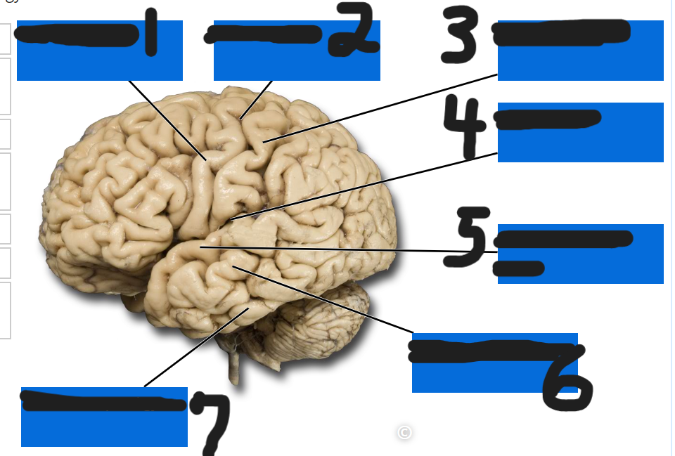 <p>what is number 1</p>