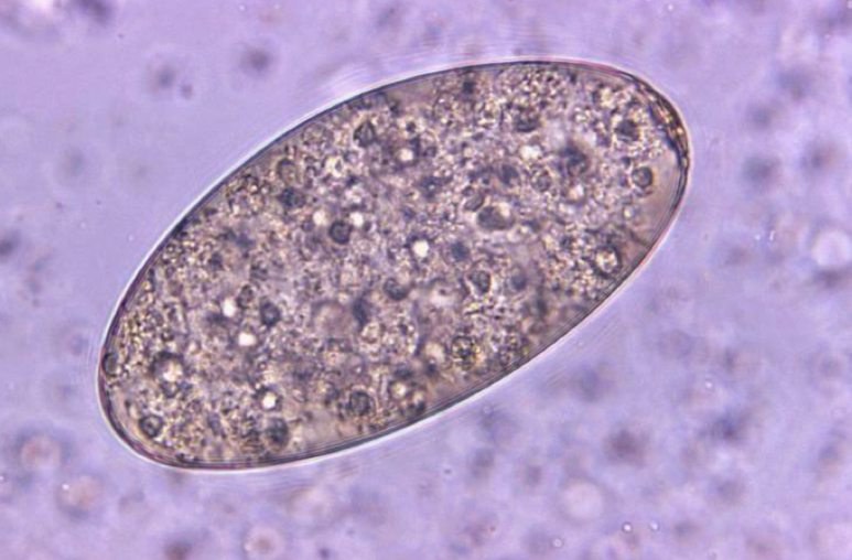 <p>Ingestion of raw water chestnuts and bamboo shoots</p>