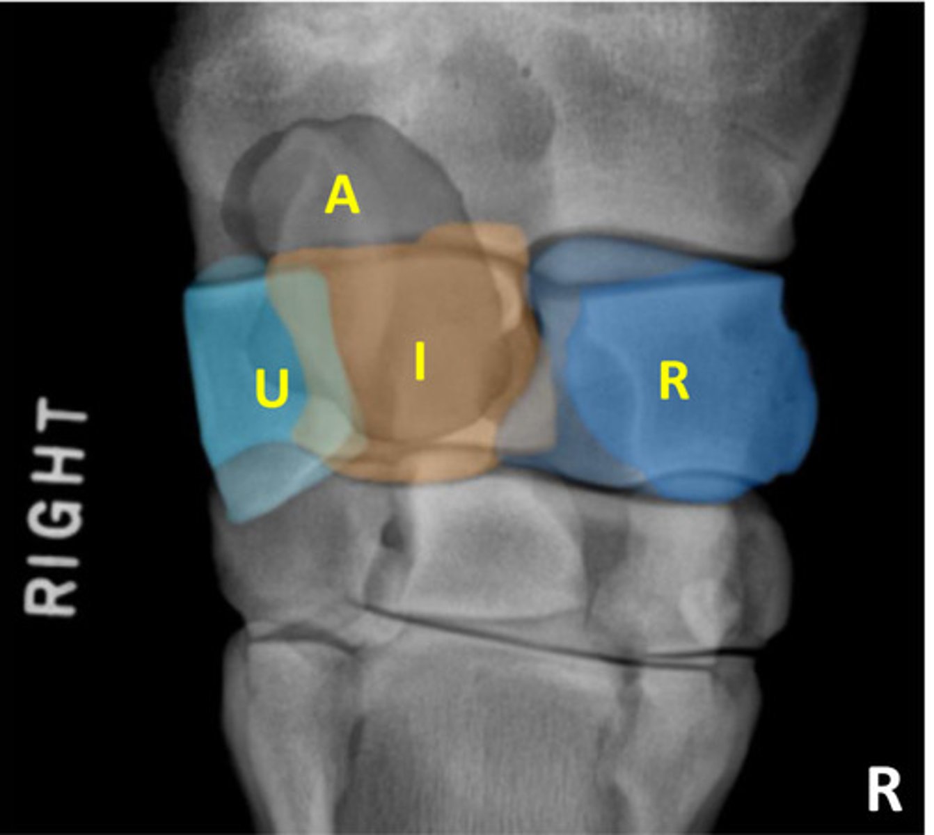 <p>What is highlighted in light blue?</p>