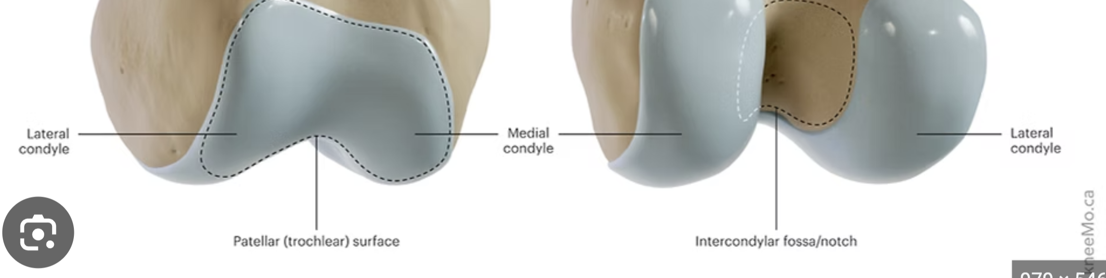 <p>Rounded bump, fits into a fossa on another bone, forming a joint</p>