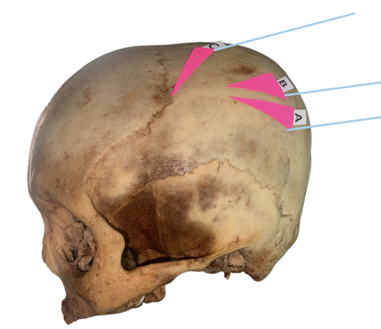 <p>Identify the structure of the skull labelled A.</p>