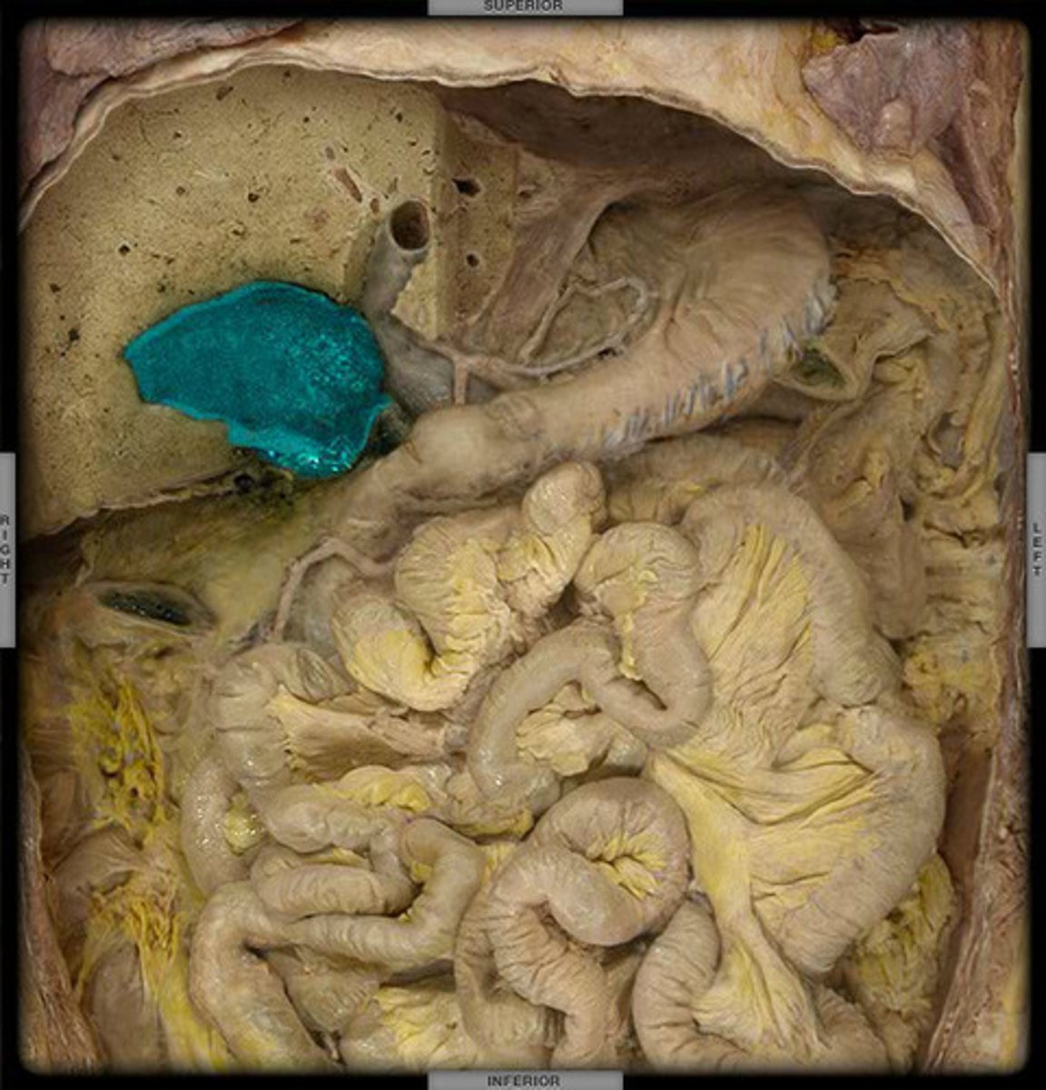 <p>A muscular sac attached to the liver that secretes bile and stores it until needed for digestion</p>