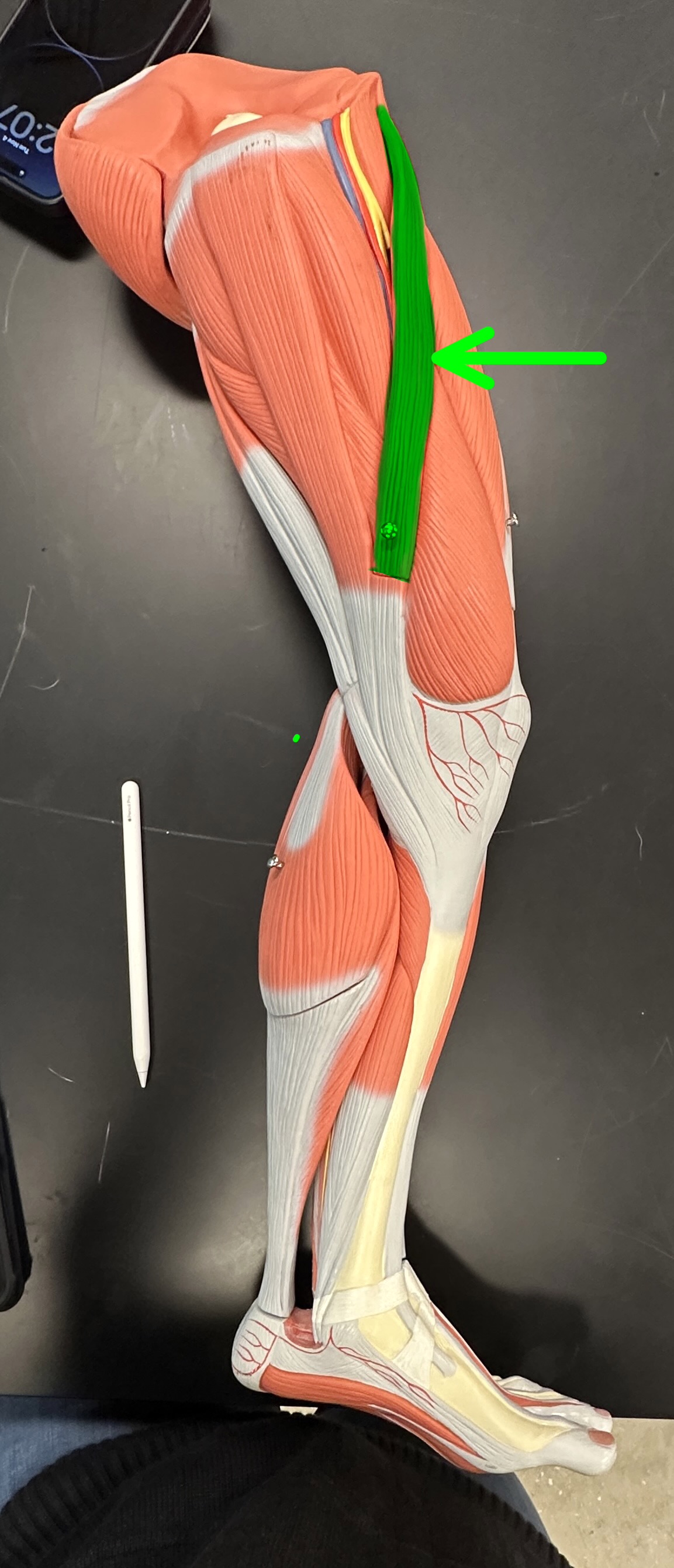 <p>What is the highlighted structure</p>