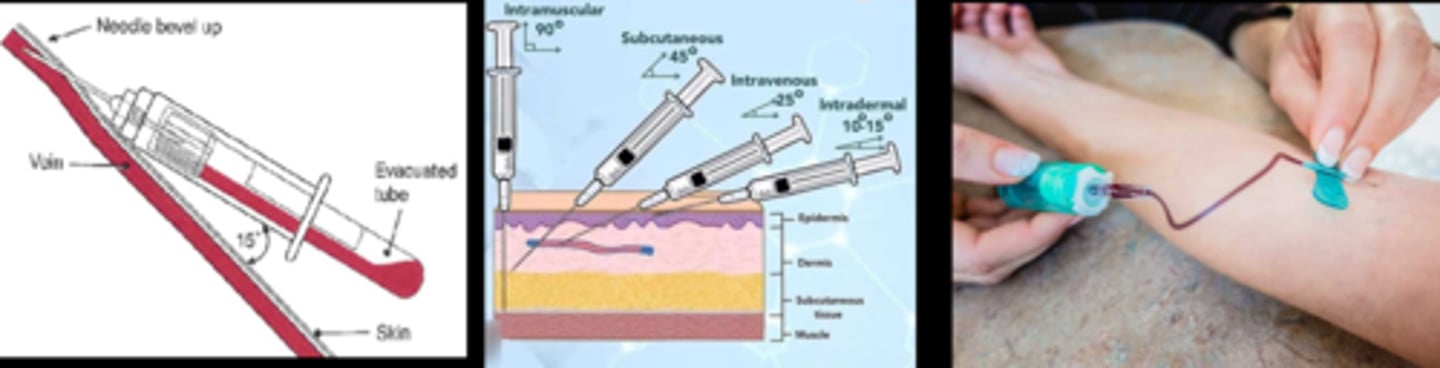 <p>1. hold skin taut at distal end</p><p>2. needle bevel up at 15-30 deg to the skin</p>