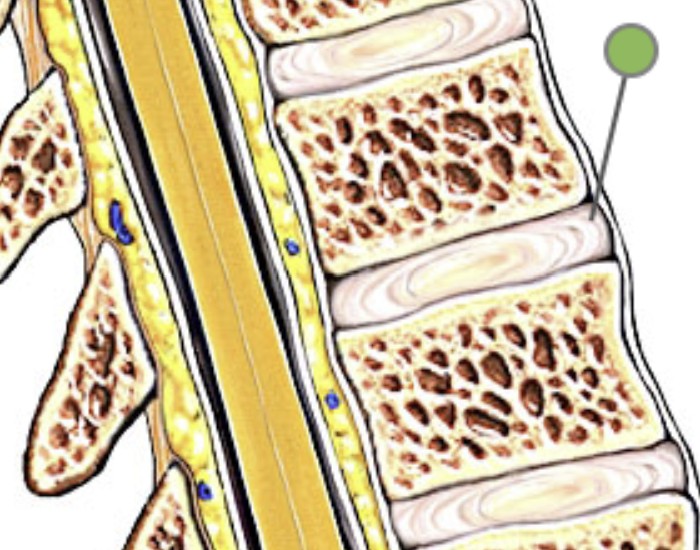 <p>What is the outer fibrous layer of intervertebral discs?</p>