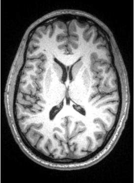 <p>Outer, Inner , myelinated </p>