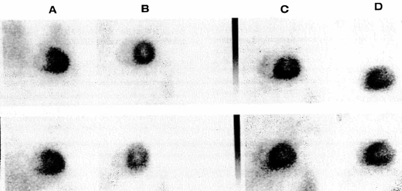 <p>What view is shown in D?</p>