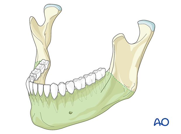 <p>The horizontal front of the mandible</p>