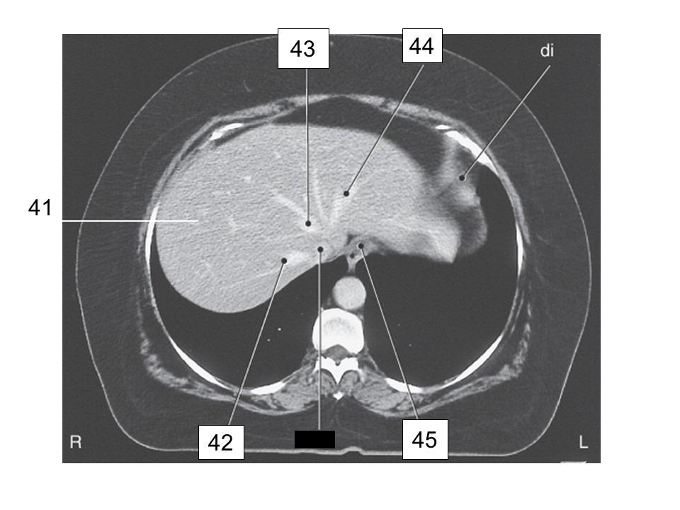 <p>identify 43</p>