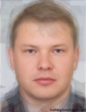 <p>Identify this Phenotype</p>