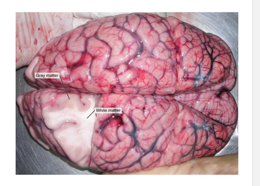 <p>Gray Matter –&nbsp;</p><ul><li><p>non myelinated area</p></li><li><p>you have cell bodies.</p></li><li><p>you have dendrites.&nbsp;</p></li><li><p>you have unmyelinated axons.</p></li><li><p></p></li></ul><p>• White Matter –</p><ul><li><p>myelinated</p></li><li><p>myelin is a fatty material - white color</p></li></ul><p></p>