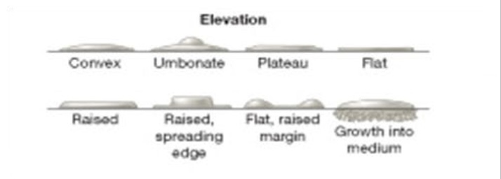<p>Can be flat, raised, convex, umbonate, plateau, or grow into the medium.</p>