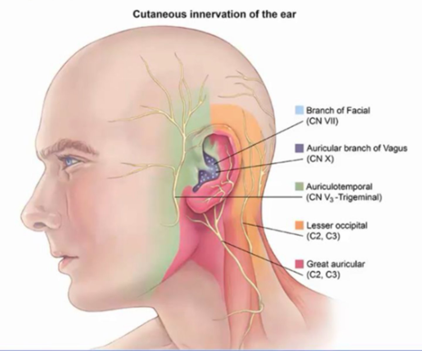 <p>V3 of trigeminal</p><p>Supplies lateral upper half of pinna</p><p>May refer from dental disease or TMJ dysfunction, parotid, tongue, nose, sinuses</p><p>Pathologies:</p><p>- trigeminal neuralgia</p><p>- dental disease</p><p>- TMJ dysfunction</p><p>- parotid infection/tumour</p>
