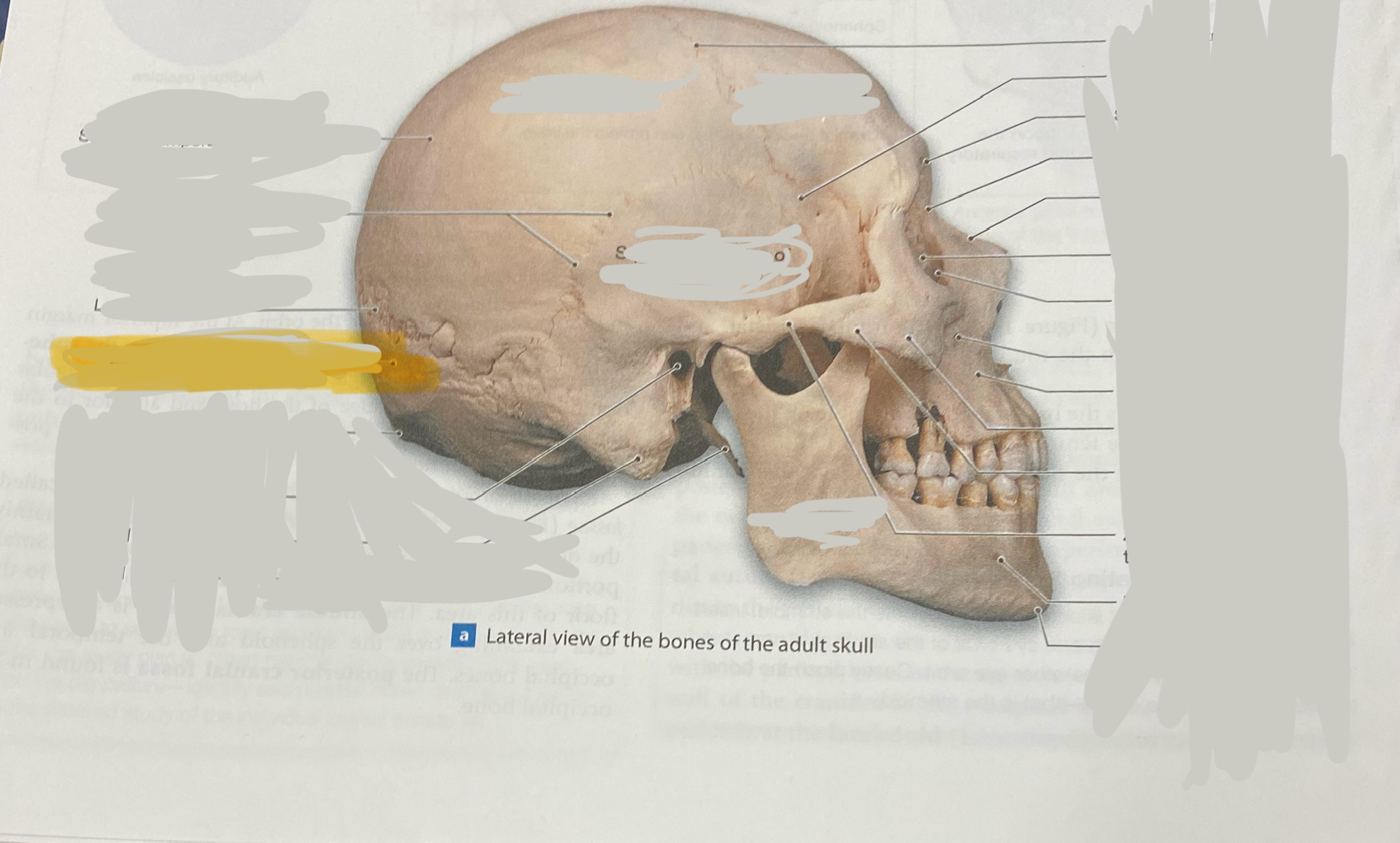 <p>What bone is this?</p>