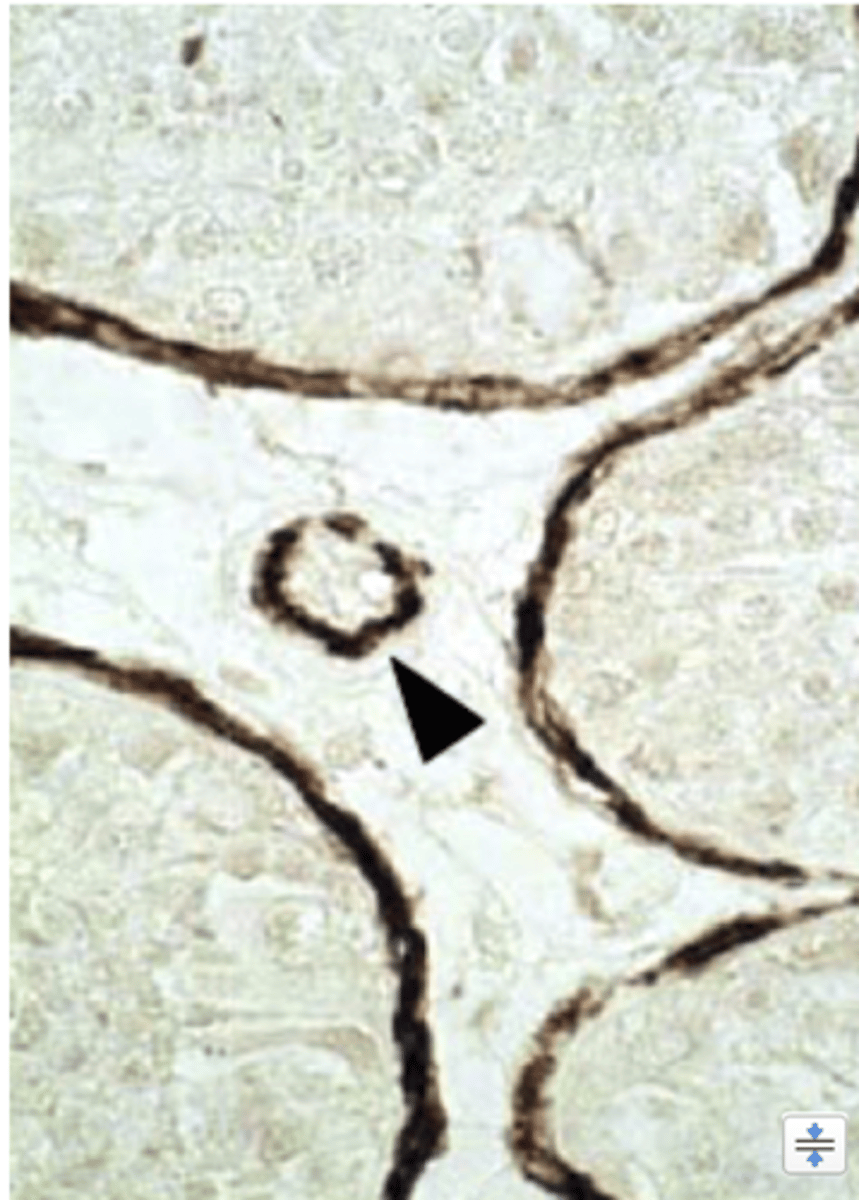<p>What type of cells?</p>
