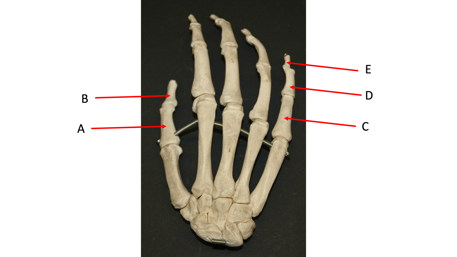 <p>a</p>