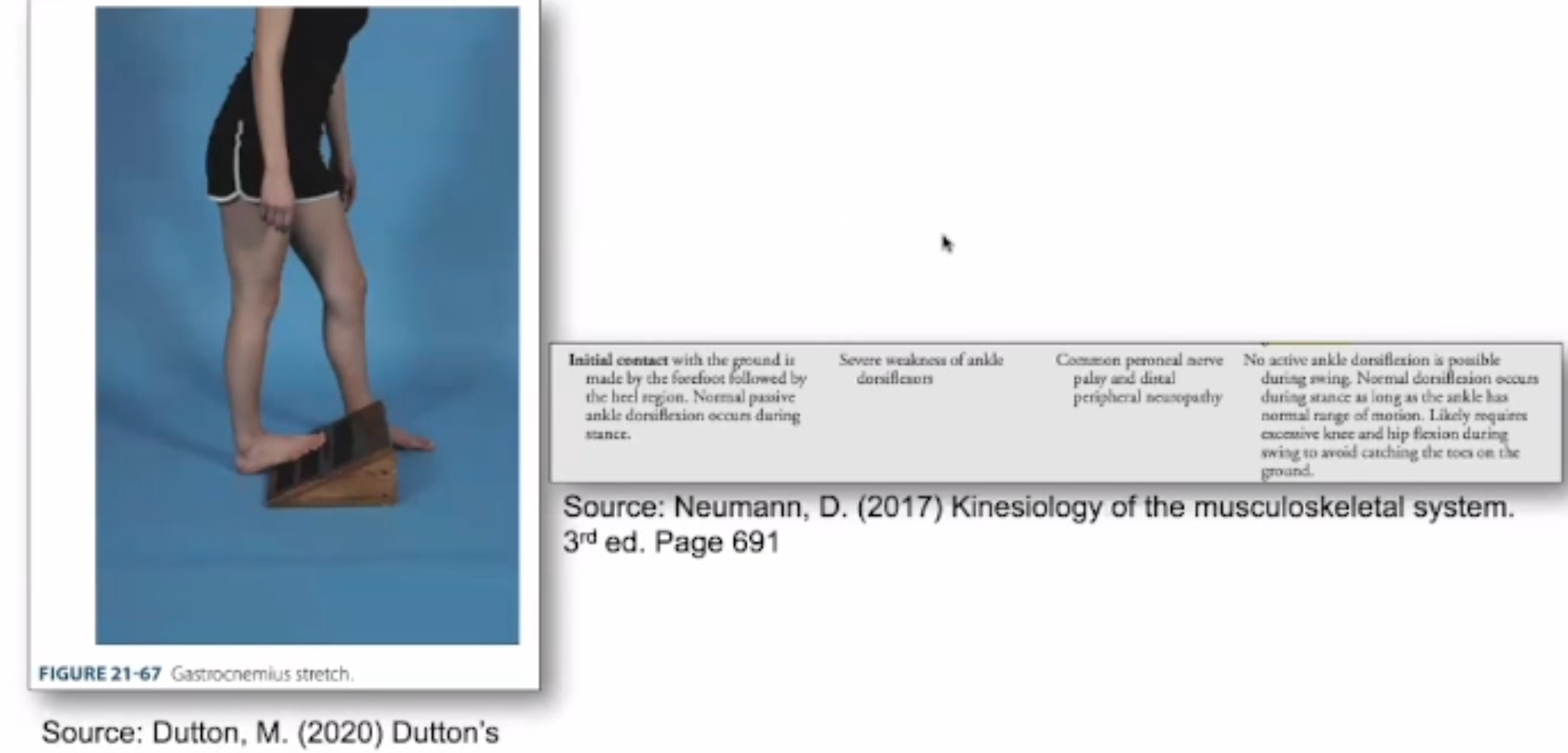 <ul><li><p>D</p></li></ul><p></p><ul><li><p>A - Achilles Tendon Rupture </p></li><li><p>B - ““ </p></li><li><p>C - ““</p></li></ul><p></p>