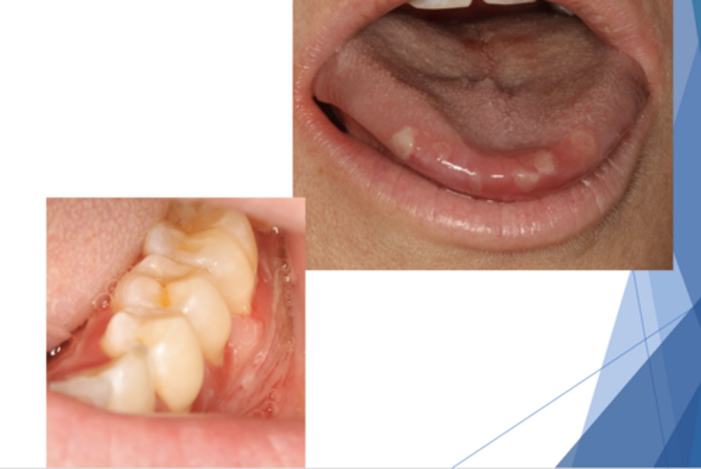 <p>What condition?</p>