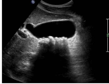 <p>What is this </p>