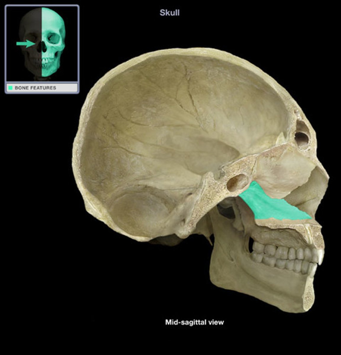 <p>bone forming the inferior and posterior portion of the nasal septum</p>