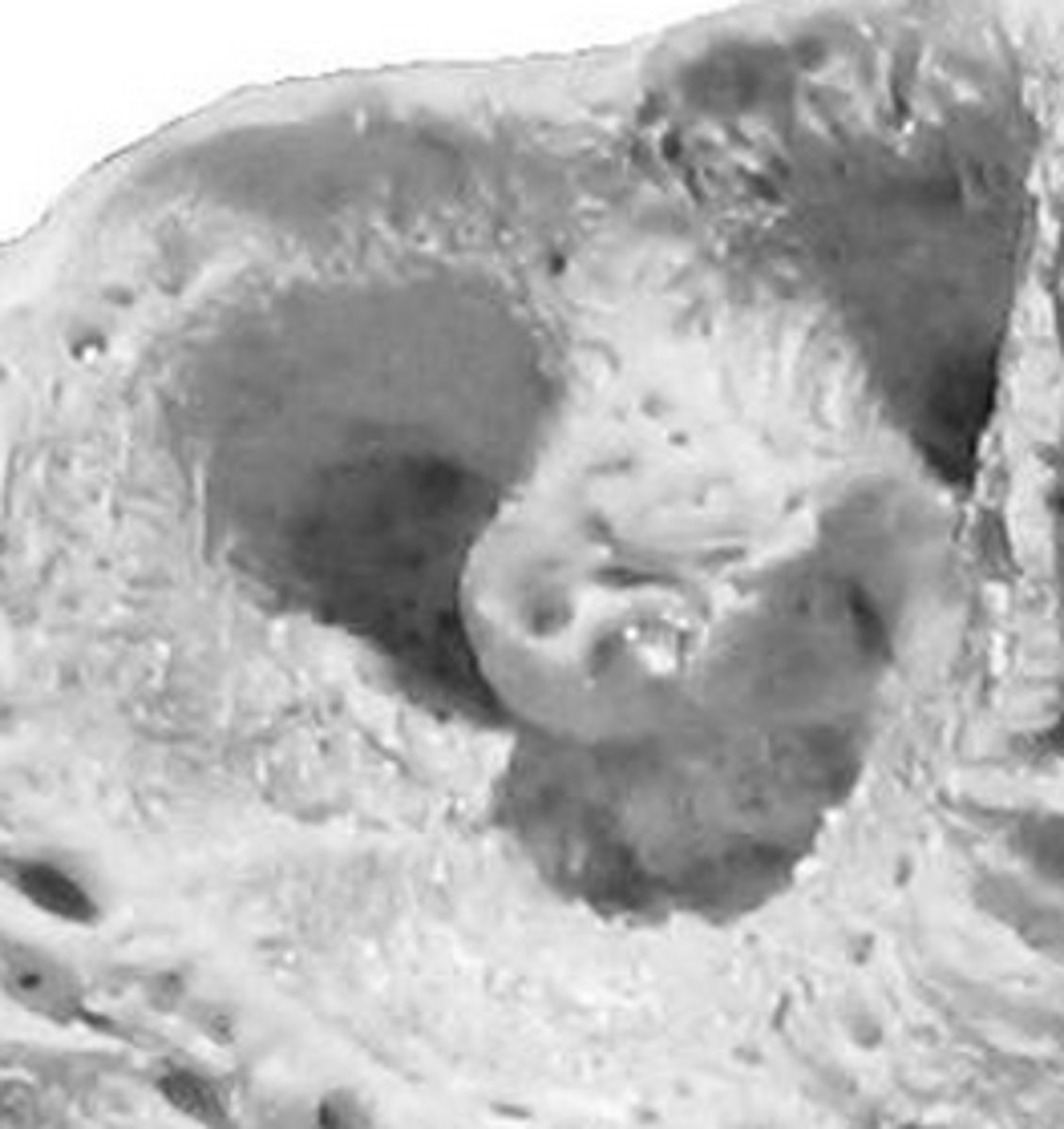 <p>Tooth socket</p>