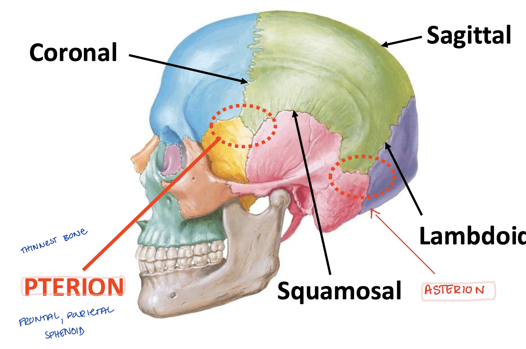 <p>-Coronal (frontal and parietal)</p><p>-Sagittal (parietals)</p><p>-Squamosal (squamous and parietal)</p><p>-Lambdoid (occipital and parietal)</p>
