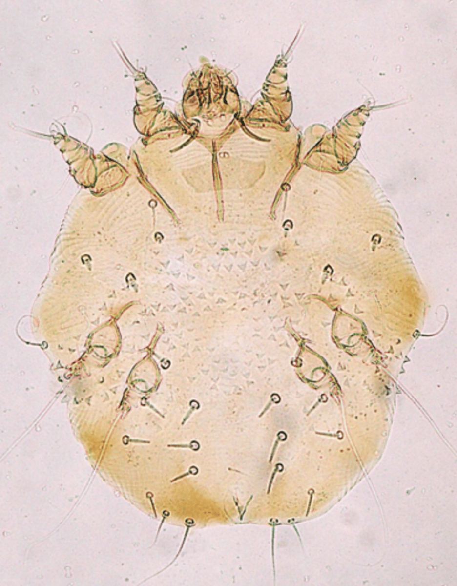 <p>what type of mite is shown?</p>
