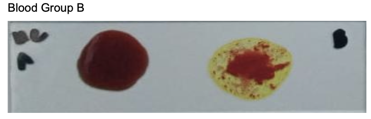 <p>Identify the:</p><ul><li><p>Blood Group</p></li><li><p>Antibody/Antibodies Present</p></li><li><p>Antigen(s) Present</p></li></ul><p></p>