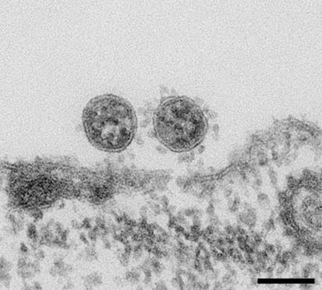 <p>Un prion est une version mal repliée d'une protéine qui peut induire d'autres protéines à se replier de manière incorrecte.</p>