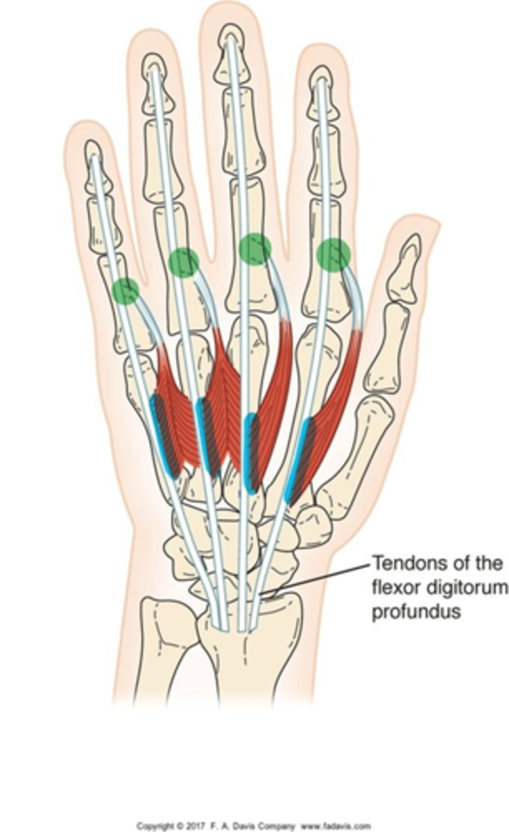 <p>Deep palm</p><p>▪O: Tendon of FDP</p><p>▪I: Tendon of ED</p><p>▪A: Flex MCP while extending PIP/DIP</p><p>▪N: I-II: median</p><p>III-IV: ulnar</p>